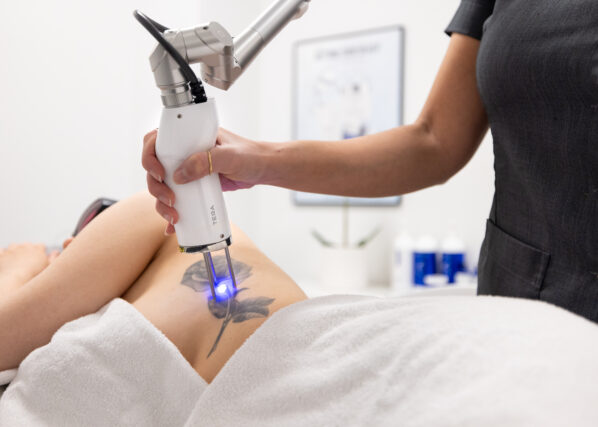 Tatueringsborttagning